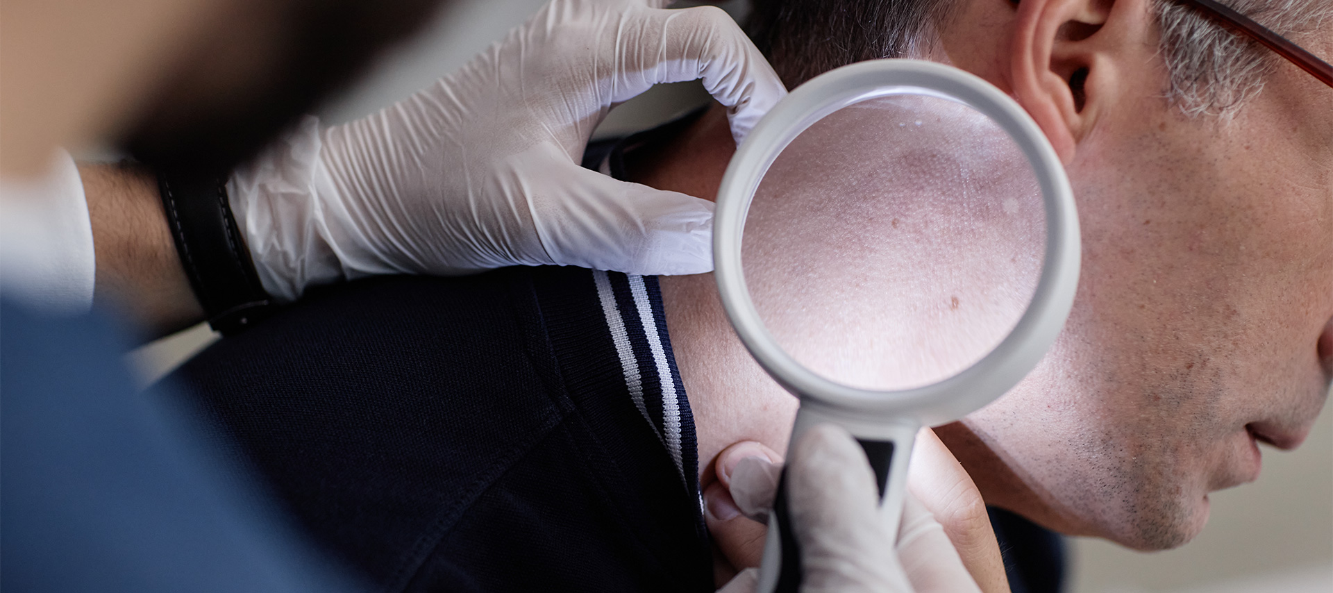 Workplace skin cancer checks at Sun Smile Clinic, a skin cancer clinic near Bringelly NSW